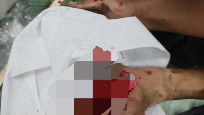 Dua Jari Putus di Pabrik Sedotan, Sistem Kerja HL PT Hokkan Deltapack Dipertanyakan